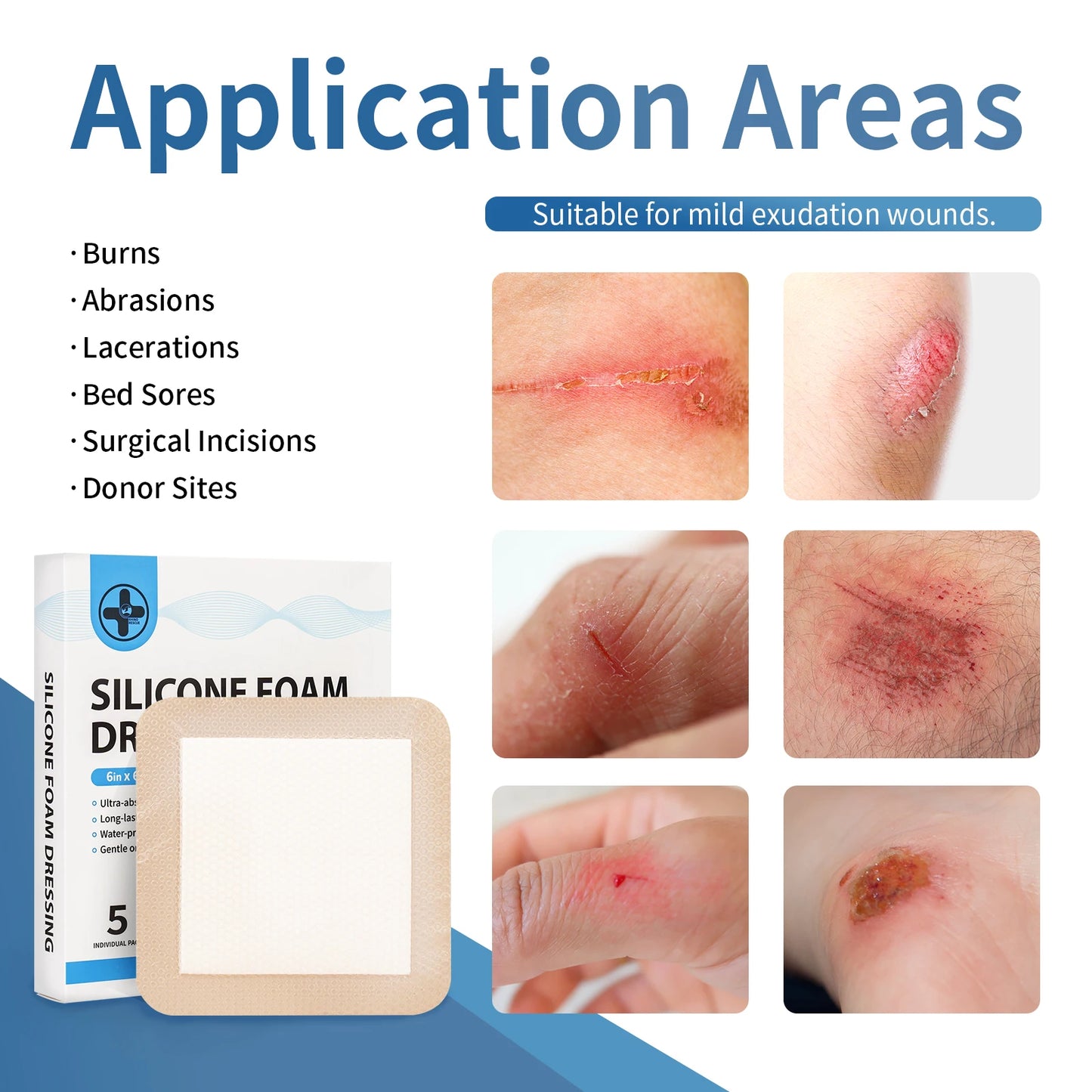 Silicone Foam Dressing - Pack of 10, ideal for advanced wound care, managing exudate, and promoting comfort.